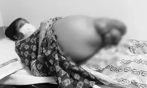 దేశంలోనే ఫస్ట్టైమ్.. 12 కిలోల కాలేయాన్ని తొలగించిన కిమ్స్ వైద్యులు