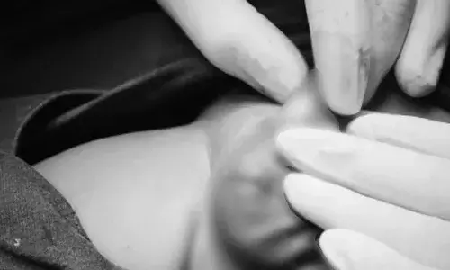 3 నెల‌ల బాలుడికి అరుదైన వృష‌ణాల స‌మ‌స్య‌.. విజ‌య‌వంతంగా చికిత్స చేసిన ఏఐఎన్‌యూ వైద్యులు