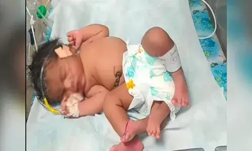 నాలుగు కాళ్ల ఆడబిడ్డకు జన్మనిచ్చిన మహిళ.. మధ్యప్రదేశ్‌లో ఘటన
