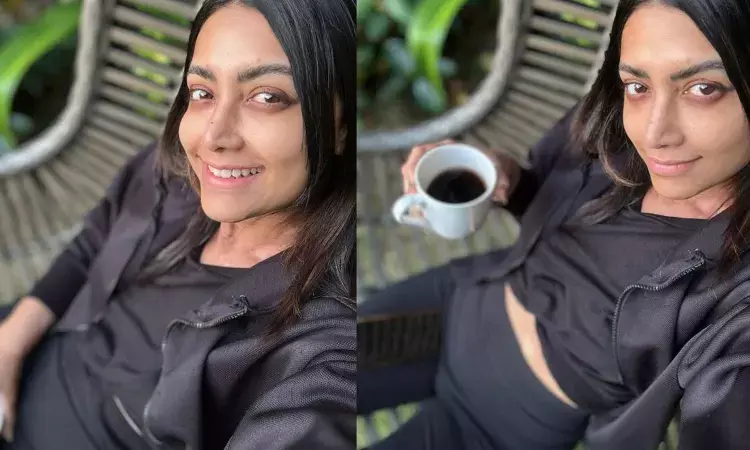 ఆ హీరోయిన్‌కు అరుదైన వ్యాధి.. అయ్యో ఇలా మారిపోయిందేంటి