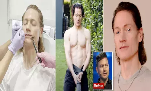 అతడికి 45 ఏళ్లు.. 18 ఏళ్ల యువకుడిలా మారాలని.. ప్రతి ఏడాది రూ.16 కోట్లు