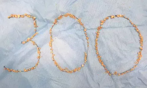 AINU,Hitec city,Kidney stones