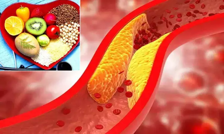 Bad cholesterol, lifestyle