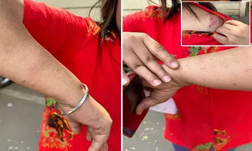 stray dogs, Gurugram