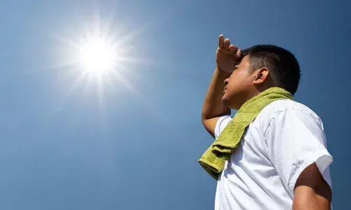 sunburn, summer, health care, health information