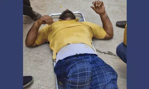 Amazon delivery boy, dog attack, Hyderabad