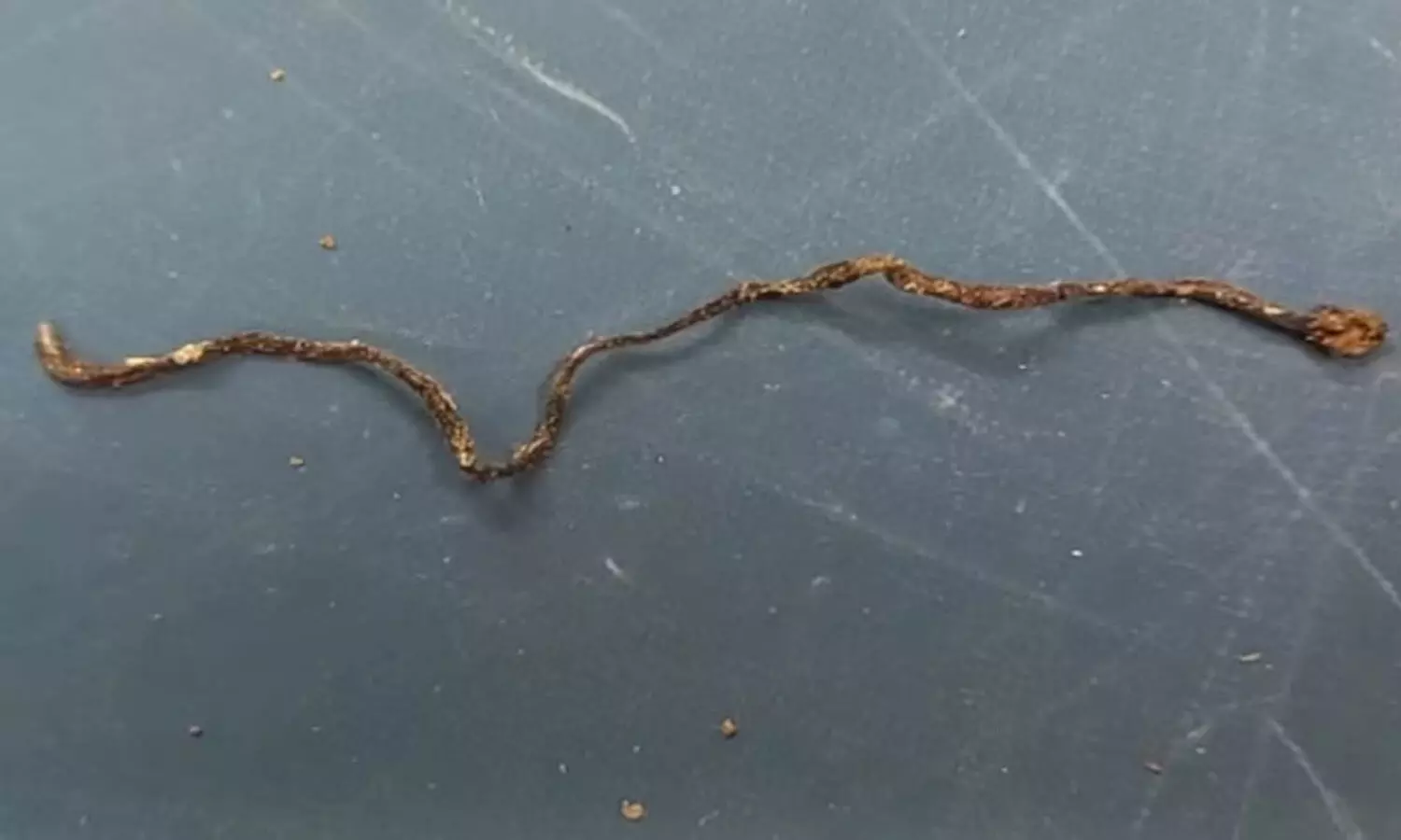 3 year old boy, snake, Uttar Pradesh, Farrukhabad