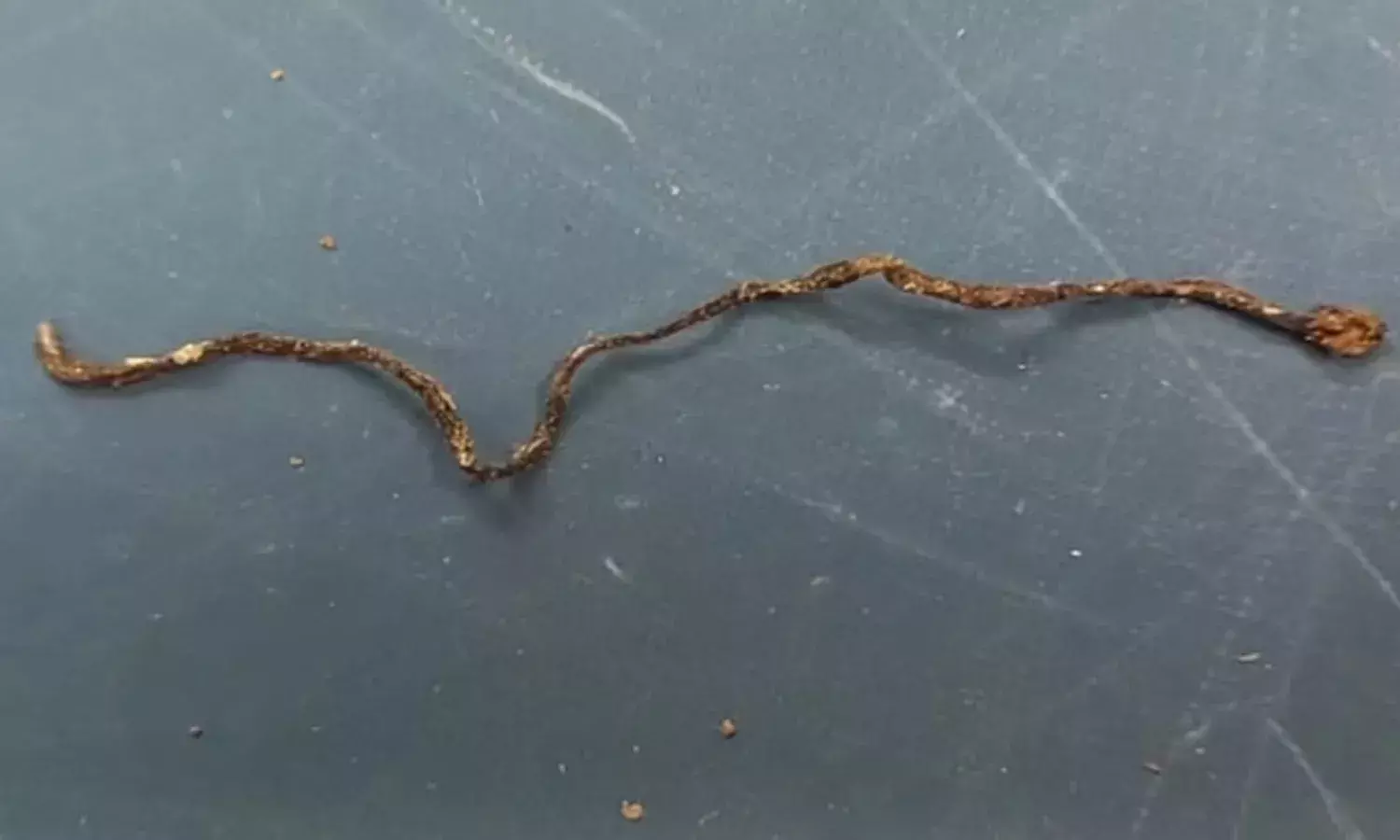 3 year old boy, snake, Uttar Pradesh, Farrukhabad