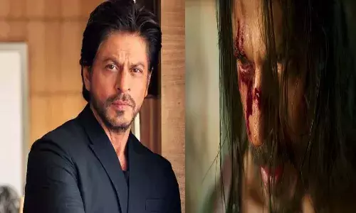 Bollywood, Shahrukh Khan, Accident, injured, America,