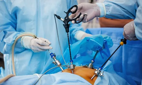 Kims, kidney Transplant, Laparoscopic surgery