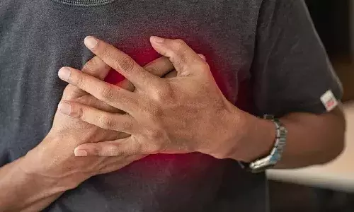 STEMI Project, AP government, heart attack, APnews