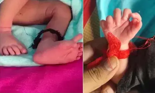 26 fingers Baby born, Rajasthan, Viralnews