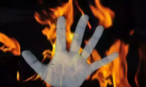 Assam woman burnt, witchcraft , Assam Police