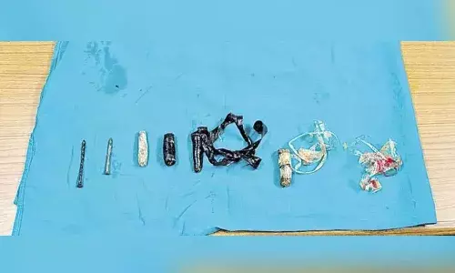 Doctors, sharp objects, Chanchalguda prisoner, Hyderabad