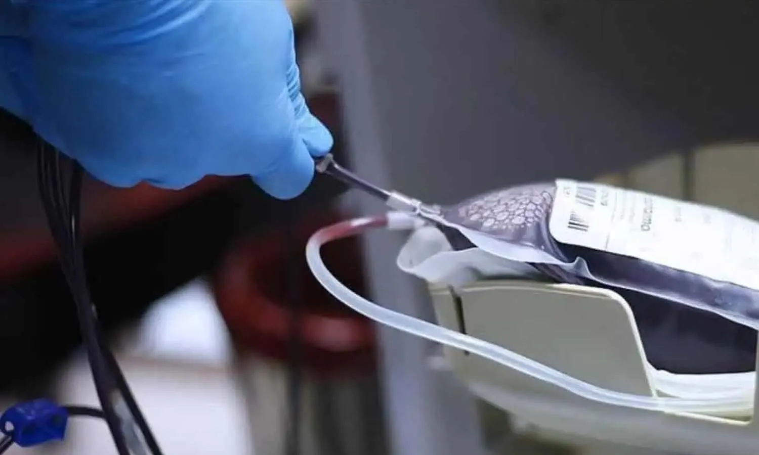 Telangana, Bombay blood, pregnant woman, Andhra Pradesh