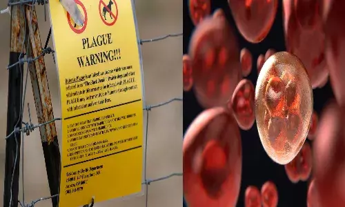 US,  bubonic plague,  local man,