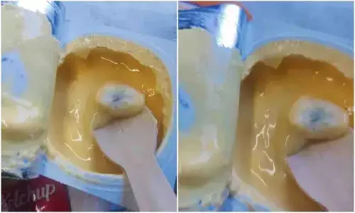 ఆ ఫుడ్ లో ఫంగస్.. ఎలా తినాలంటూ గగ్గోలు..!