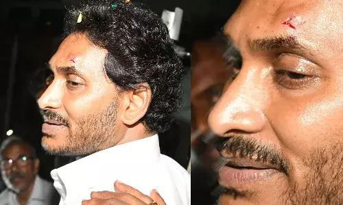 ఎన్నికల ప్రచారంలో సీఎం జగన్పై దాడి.. కనుబొమ్మపై గాయం