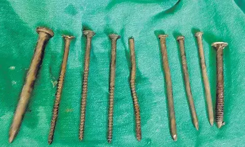 Doctors,  Gandhi Hospital, iron objects, prisoner stomach