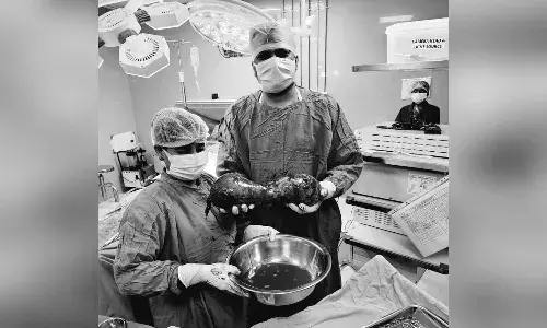 AINU doctors, huge tumor, testicles, Hyderabad