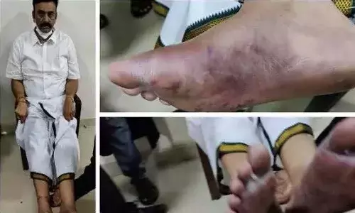 TDP leader,RaghuRamakrishnamRaju, police complaint, EX CM YS Jagan