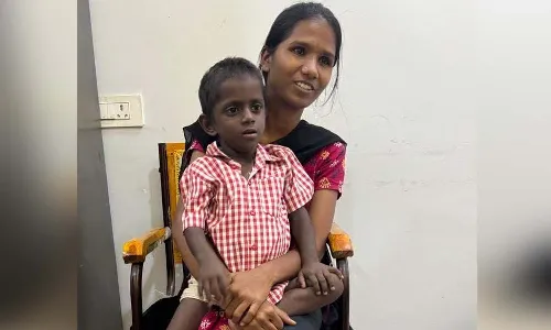 Liver transplant, Osmania Hospital, CM Revanth