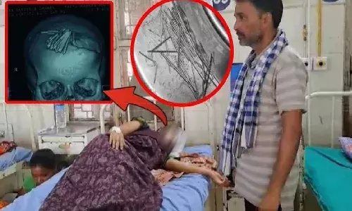 70 needles,  lady, head, odisha, doctor ,