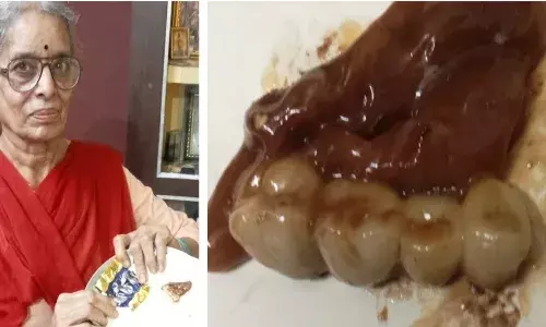 teeth set,  chocolate,  Madhya Pradesh ,