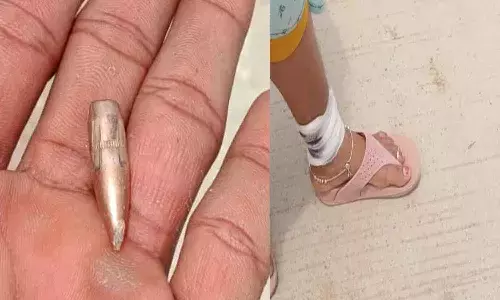 ఈ రోజు నా టైం బాగుంది.. నార్సింగిలో బుల్లెట్ తాకిన మహిళ చెప్పిందిదే..