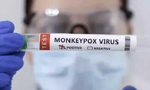 monkeypox, virus, central govt, alertm, state govts