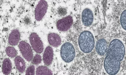 who,  mpox virus, covid,