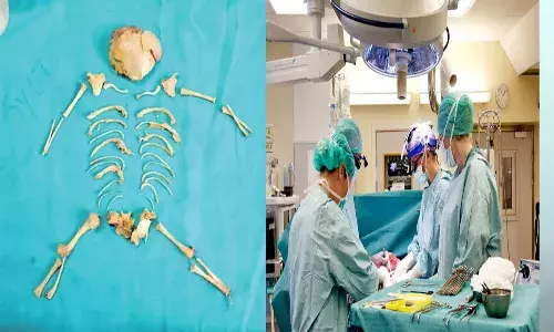 కడుపునొప్పితో ఆస్పత్రికి మహిళ, కడుపులో శిశువు ఎముకల గూడు