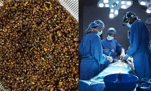 Rajasthan, stones, surgically removed, gallbladder, Kota