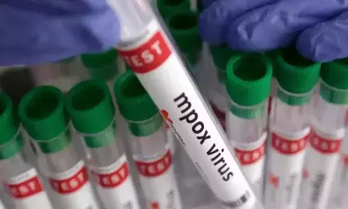అలర్ట్.. భారత్‌లో రెండో మంకీపాక్స్ కేసు నమోదు