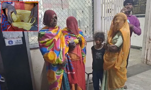 Rajasthan woman, hospital, nose in bag, Viral news