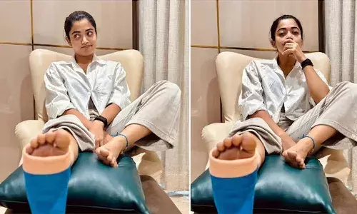Rashmika Mandanna, leg injury, directors, Bollywood, Tollywood