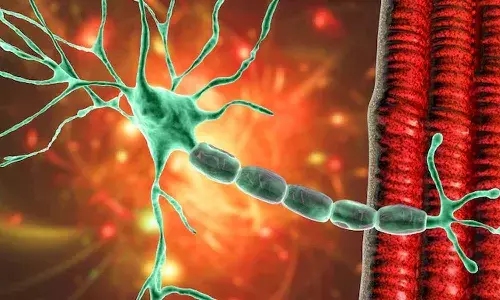 rare brain condition, Pune, Guillain Barre Syndrome