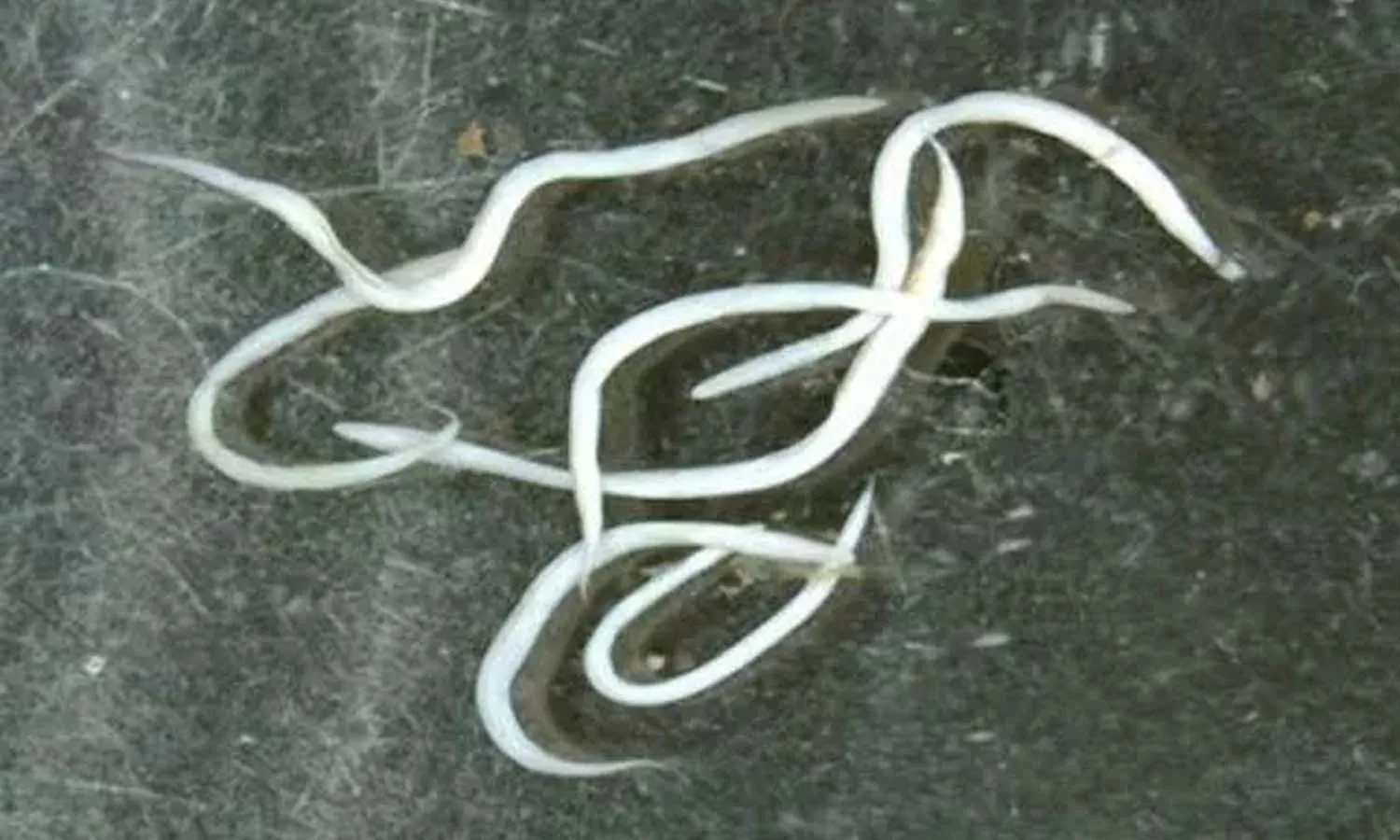 precautions, worms, stomach, Lifestyle, Health