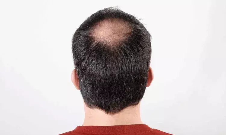 hat, helmet, bald, Life style