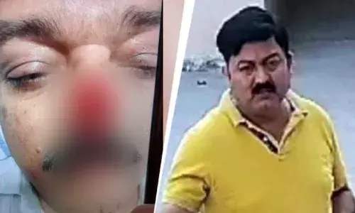 Video : పార్కింగ్ విషయంలో గొడవ.. ముక్కు కొరికేస్తారా ఎవరైనా.?