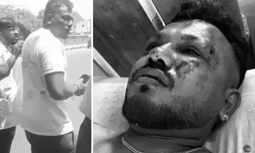 Lone survivor, Air India, crash, miraculous escape, Ahmedabad