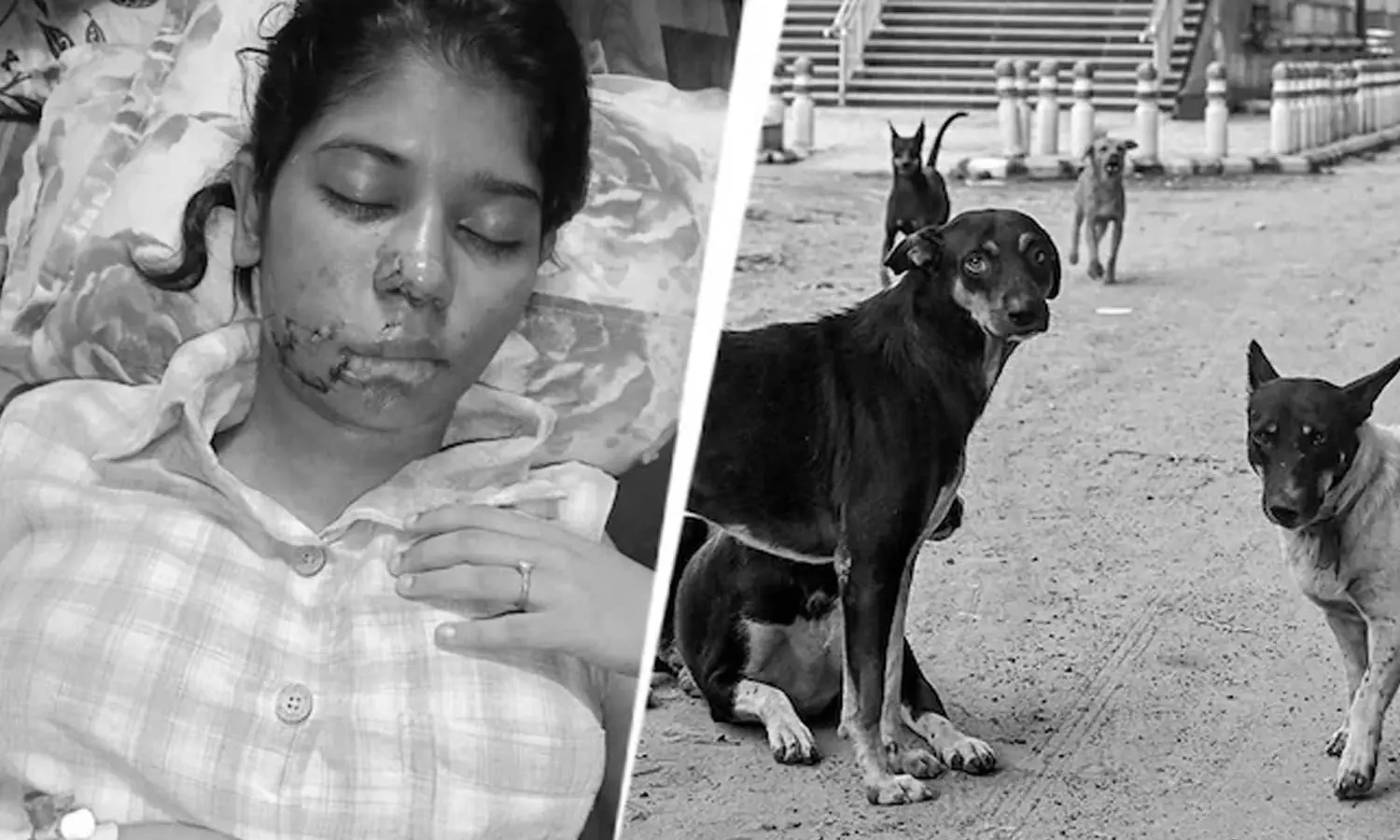 student, stitche, attack, stray dogs, Kanpur, uttarpradesh student, stitche, attack, stray dogs, Kanpur, uttarpradesh