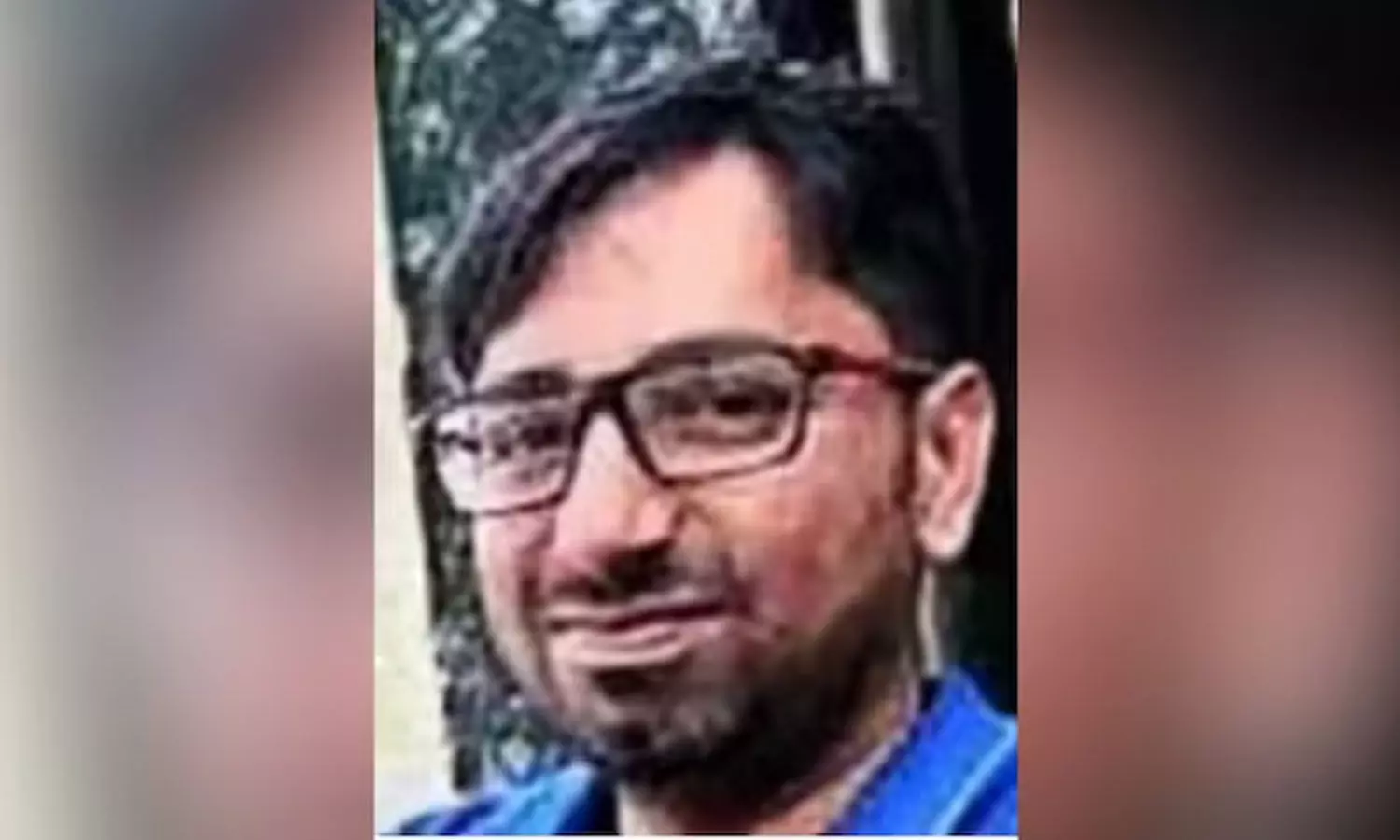 techie, Bengaluru, Snake Bite techie, Bengaluru, Snake Bite