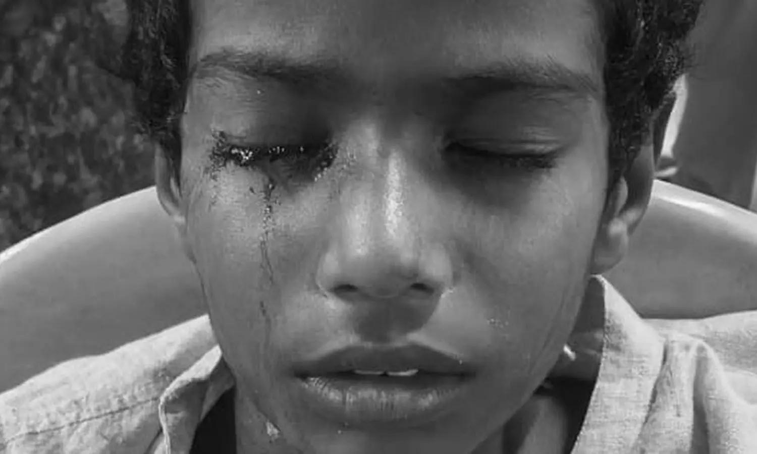 Andhrapradesh, Boy loses eye, assault, non-teaching staffer, parents demand action, school Andhrapradesh, Boy loses eye, assault, non-teaching staffer, parents demand action, school