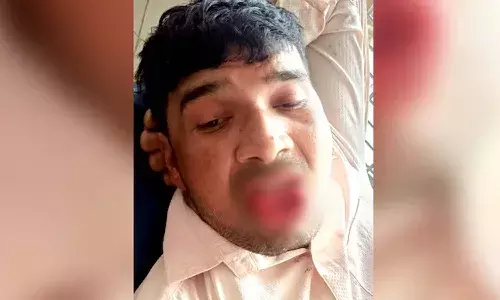 Married UP man, Man tries to kiss girl, she bites off his tongue, Crime