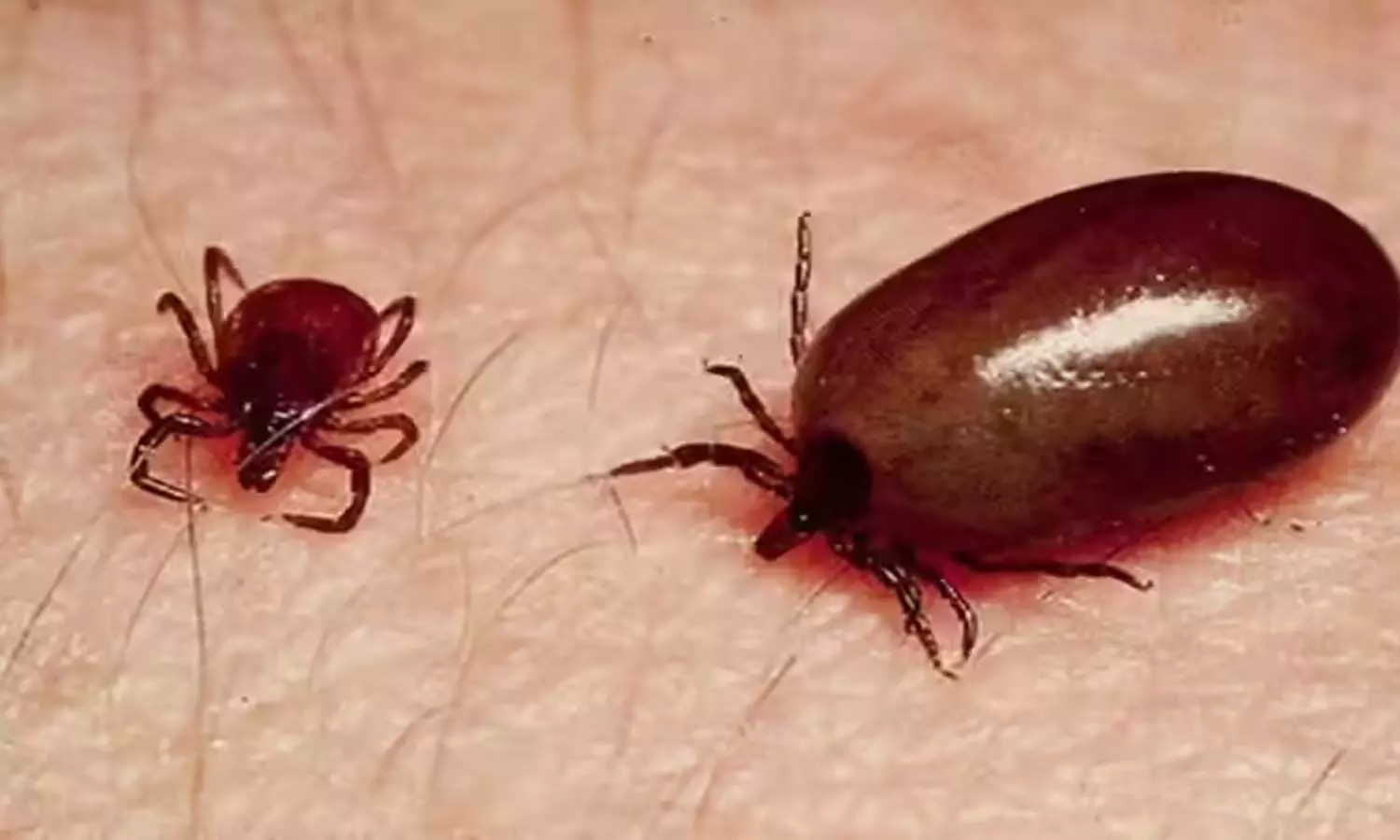 Scary insect, Scrub typhus cases,  Andhra Pradesh