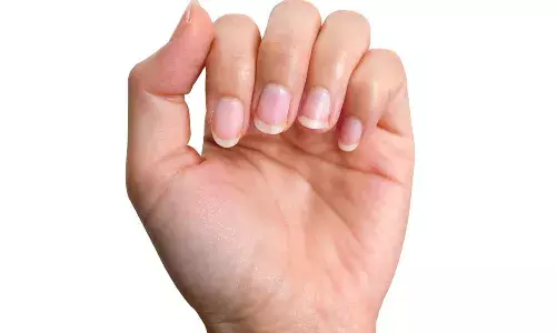 Lifestyle, illness, fingernails, Health Tips