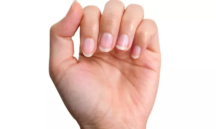 Lifestyle, illness, fingernails, Health Tips