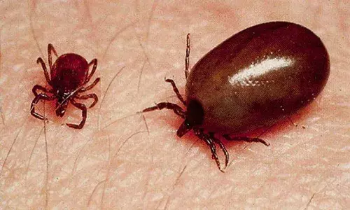 Officials, task force, Scrub Typhus , APnews