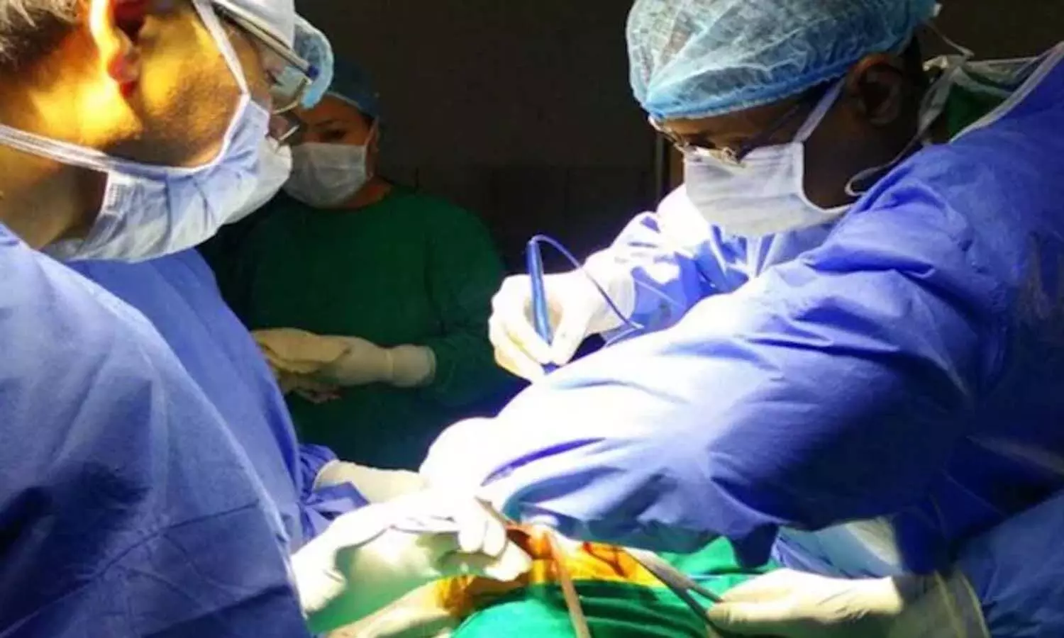 UttarPradesh, Fake doctor, surgery, YouTube, cuts intestines, patient died